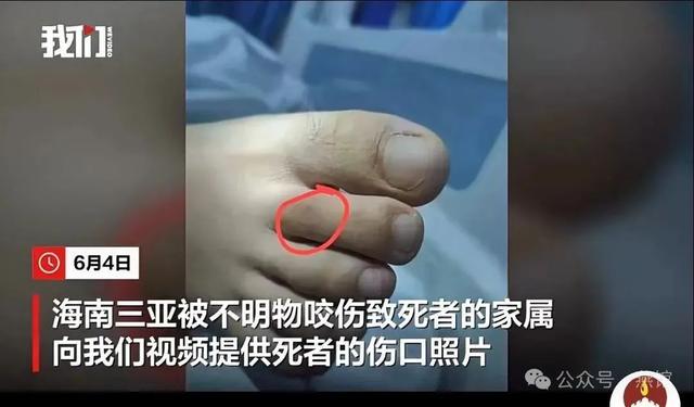 咬人事件那些忽视的真相！pg模拟器电脑版三亚毒蛇(图3)